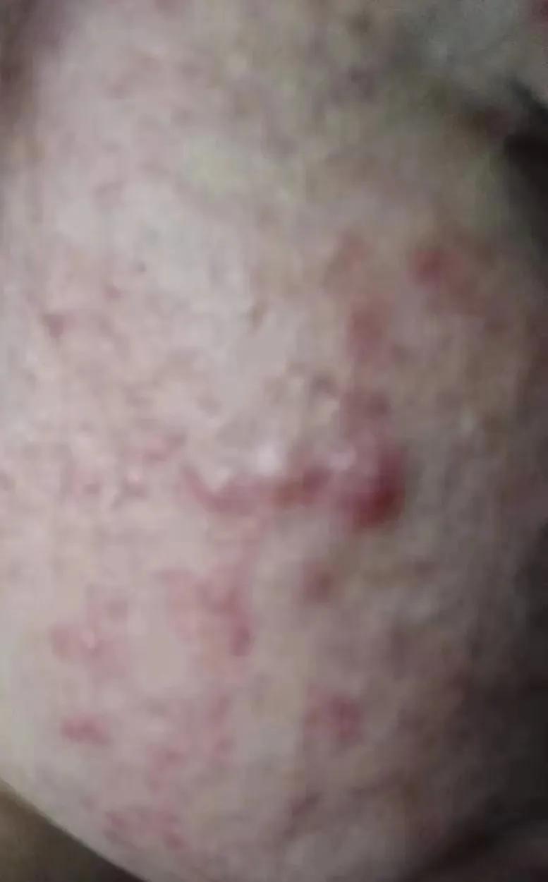 护肤踩坑没效果,沉浸式护肤的坑