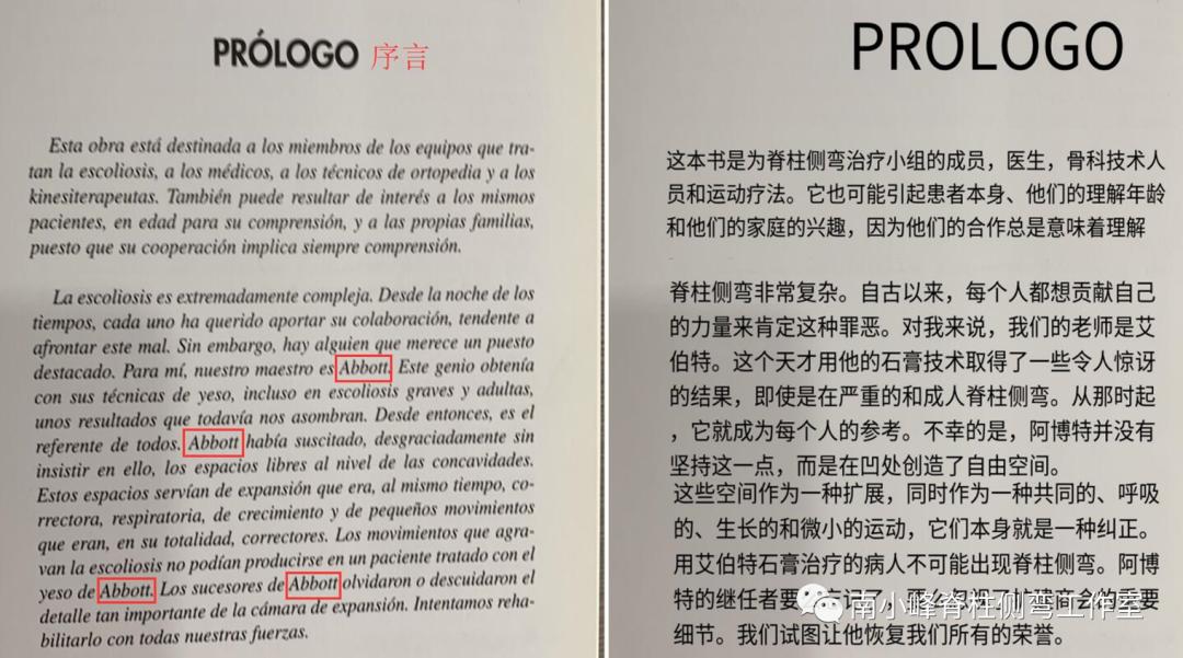 gbw硬质支具矫正脊柱侧弯,gbw支具案例