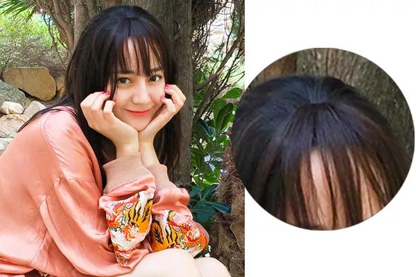 女明星秃头危机,明星们都用什么防止秃头