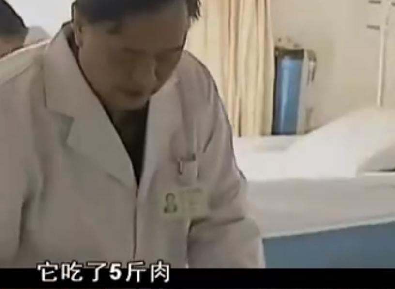 20岁小伙被重度烧伤七年后续,山东男子下肢被烧伤