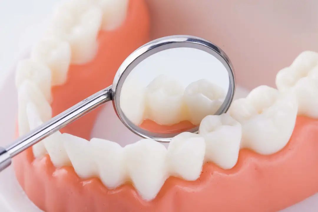 牙齿都是小裂痕是怎么回事,牙齿上有细微的裂缝该怎么办