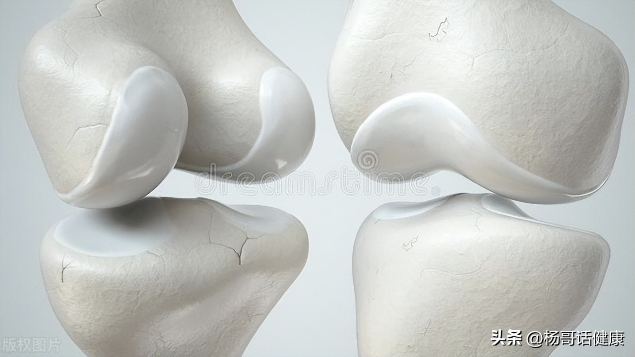 膝关节软骨磨损严重怎么治疗最好,膝关节软骨磨损严重最新治疗方法