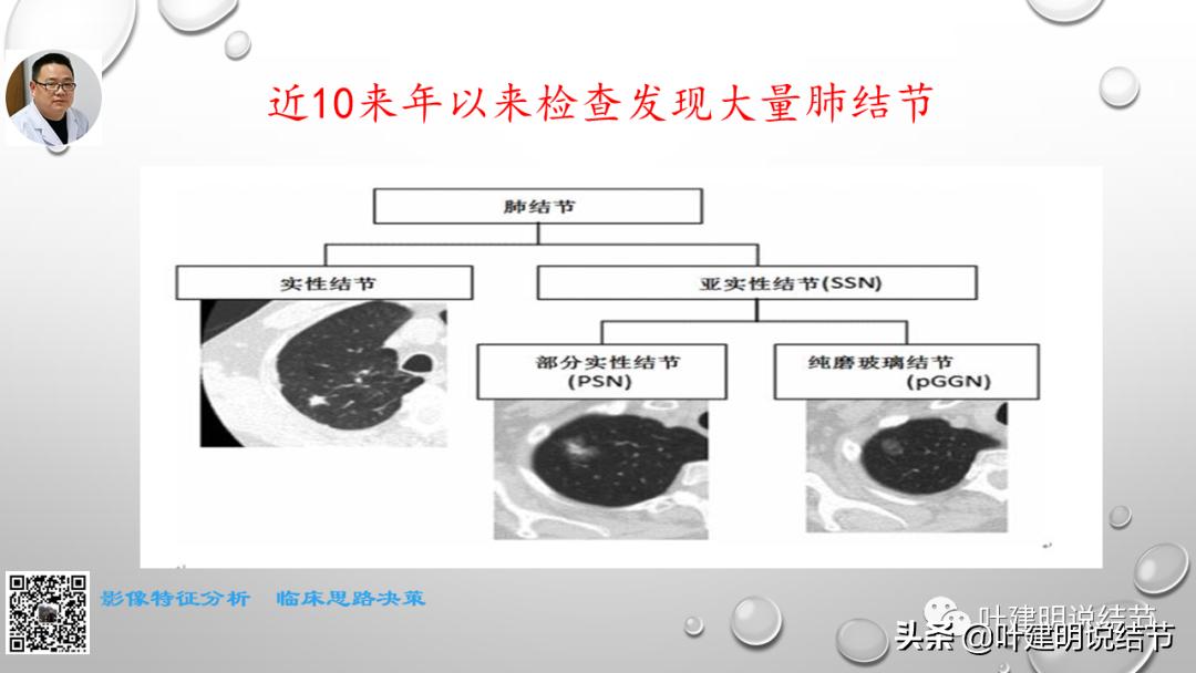 在《一脉阳光》呼吸影像诊断专题培训班上的讲课PPT（第一部分）