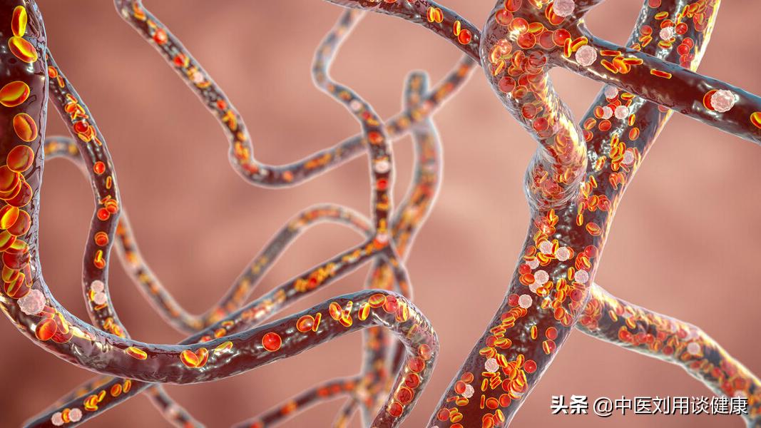 血瘀体质的识别与调理,血瘀体质的表现症状及调理方法