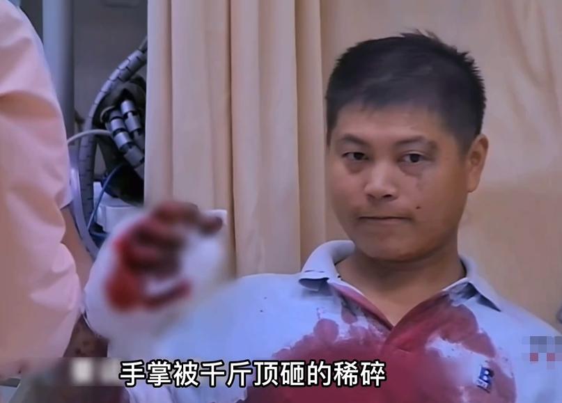 29岁工人手掌被千斤顶,工人手掌遭千斤顶砸碎后续