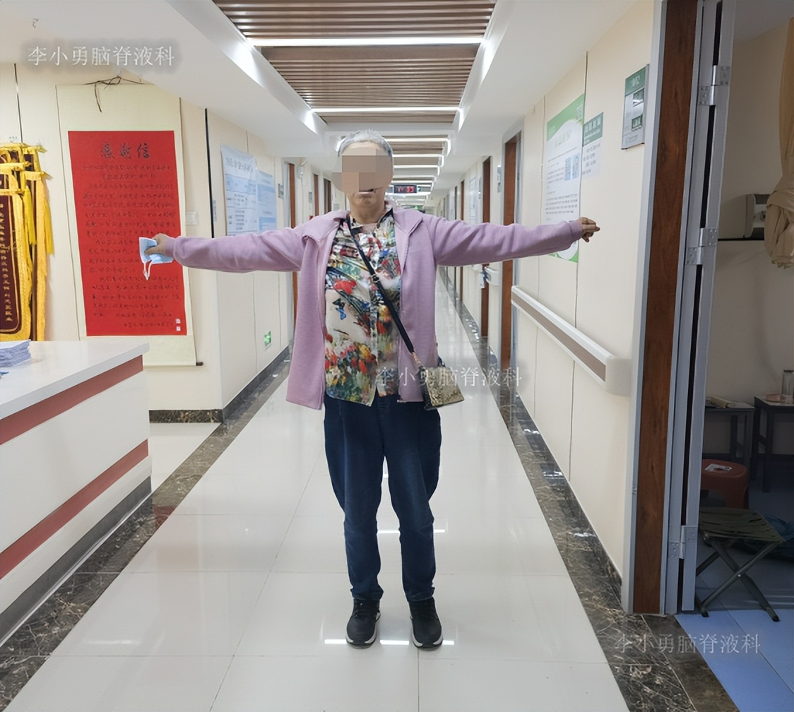 脑积水手术后4天还呕吐怎么回事,脑积水分流术后一直腹部疼痛