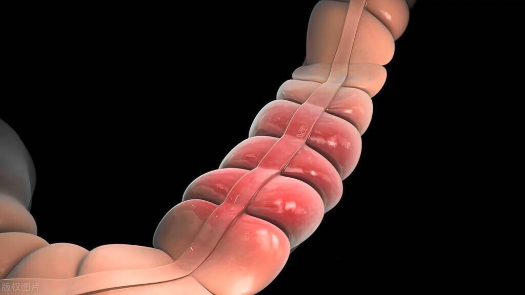 “医生，我痔疮都切了，为啥还便血？”警惕：这种情况一定要重视