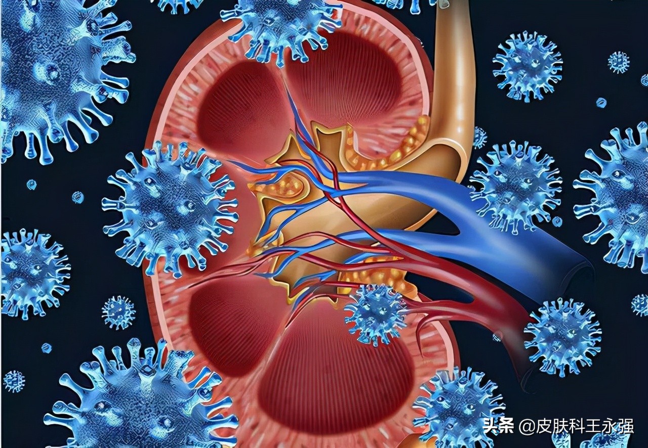 疥螨是怎样引起的,疥螨引起的症状