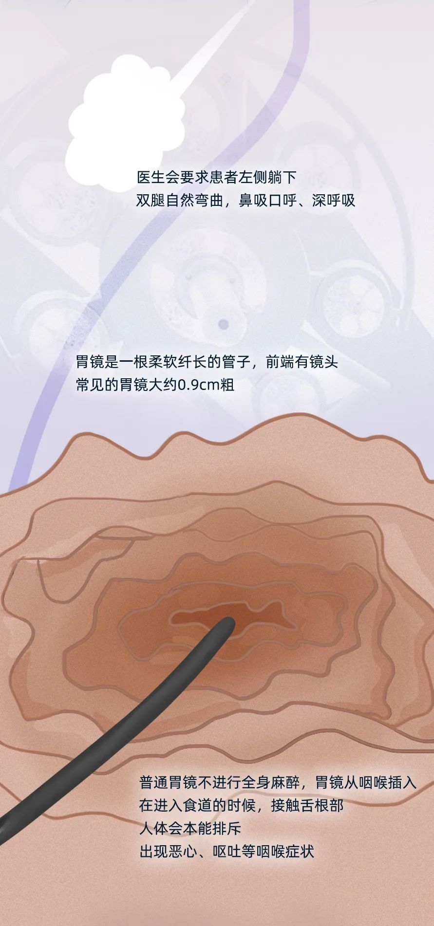 胃镜检查全过程小视频,胃镜检查全过程有哪些