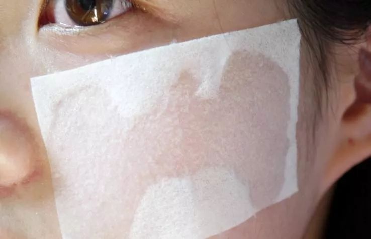 怎么用护肤品预防闭口粉刺,如何预防闭口粉刺