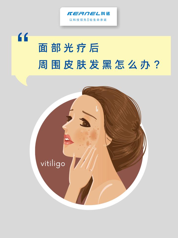 光疗导致周围皮肤变黑,光疗后皮肤变黑多久会恢复