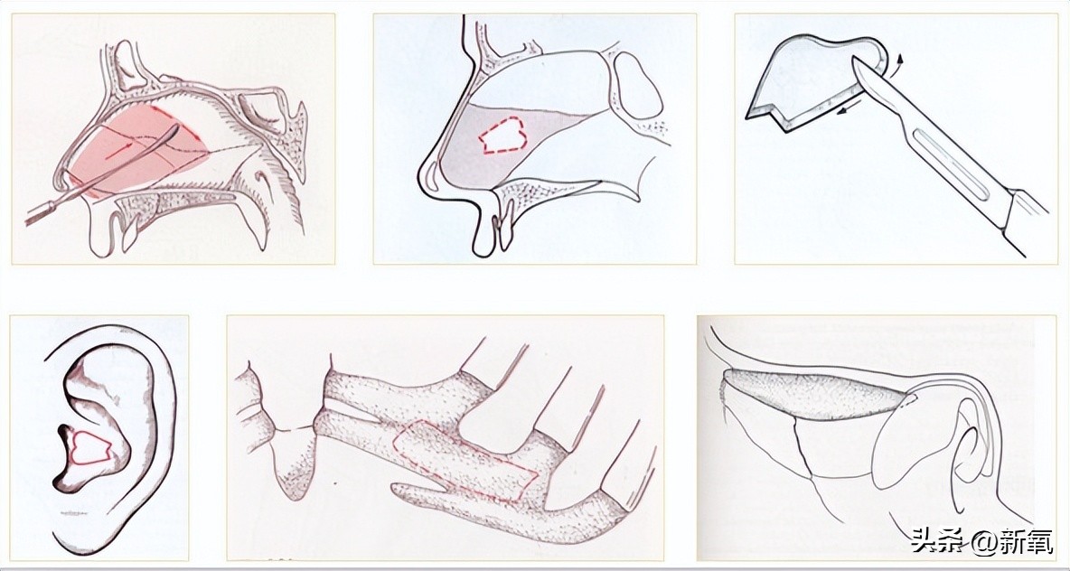 改一点赢很大？她整完鼻子直接美成断代神颜…