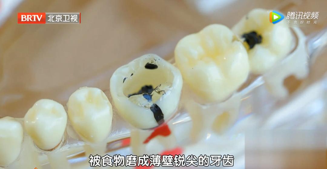 几元和几十元的牙膏区别,几十块钱的牙膏能去皱纹吗