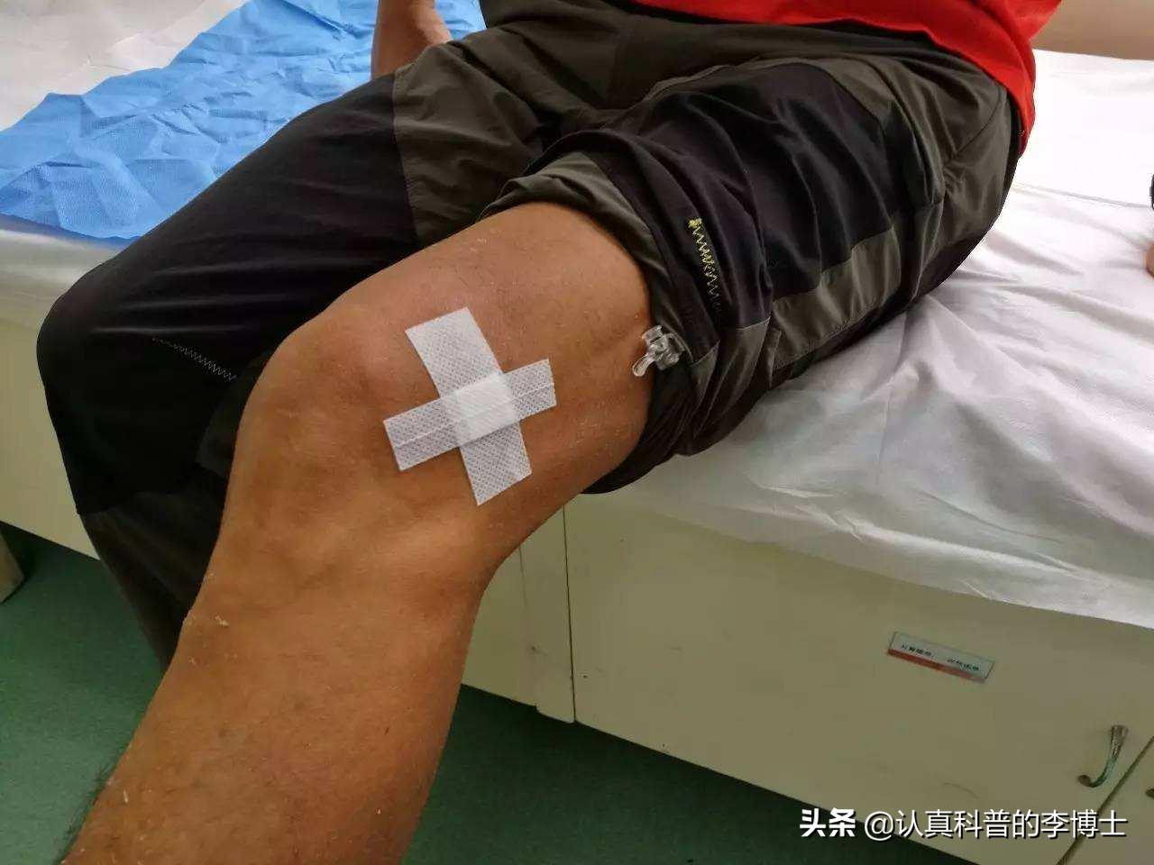 关节有积液需要抽吗,抽关节积液有什么危害