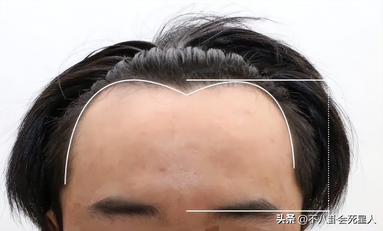 杨幂用生发液长出头发,杨幂的生发液长出头发了