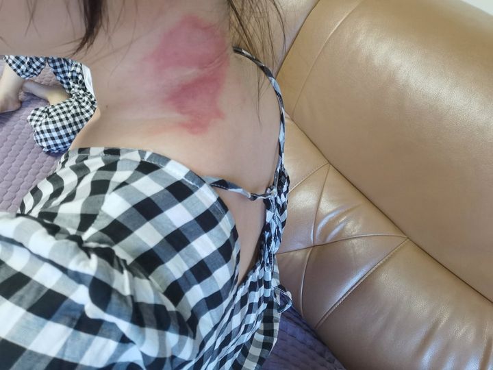 有剧毒的常见小虫子,家里面有这种虫子不要用手拍