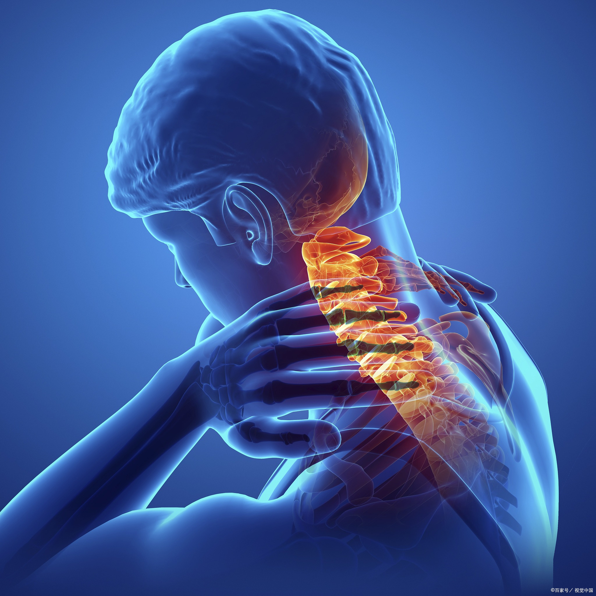 大夫，我得了颈肩综合征，怎么办？