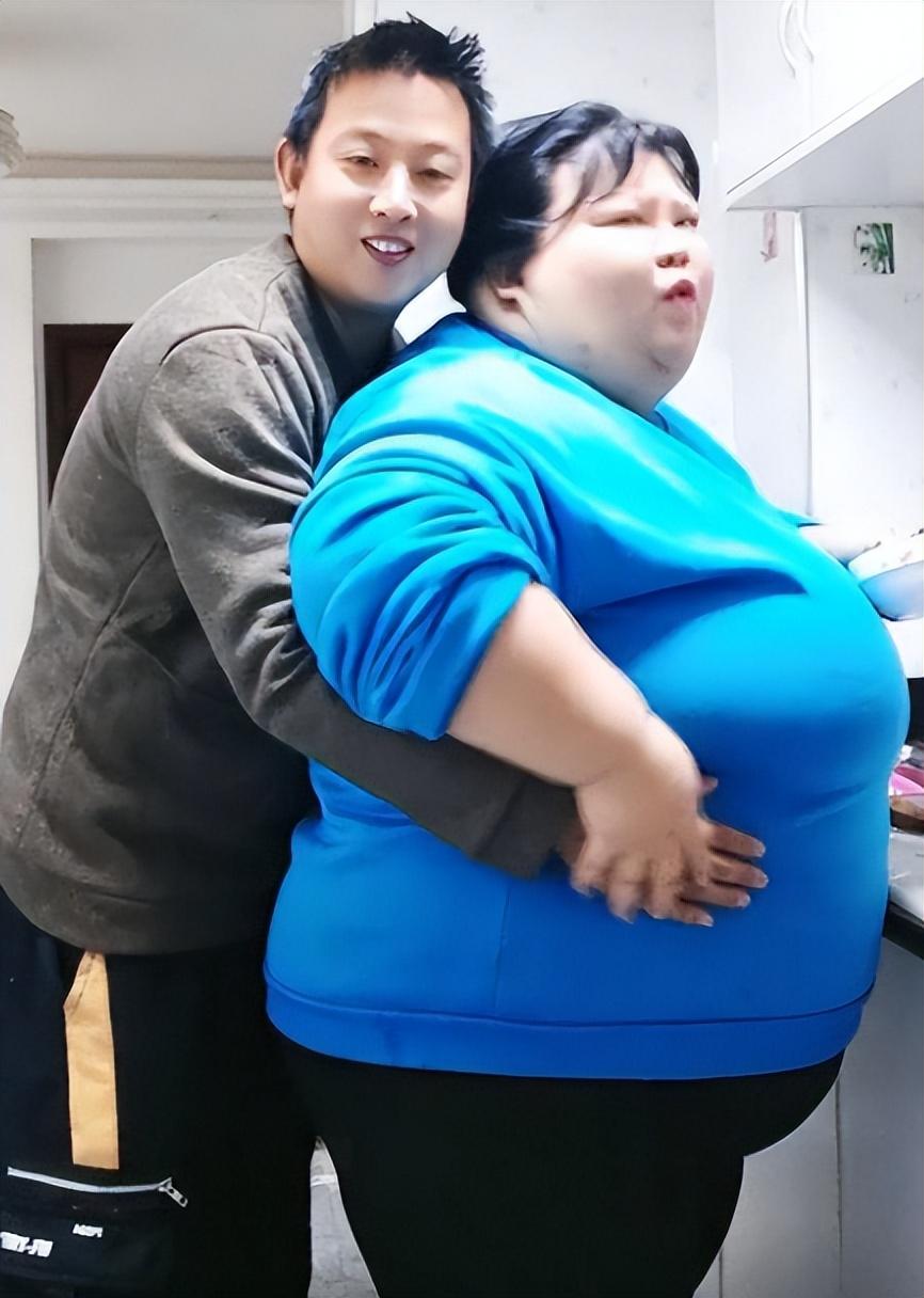 当年校花被丈夫养胖三百多斤,结婚3年校花被丈夫喂胖到332斤