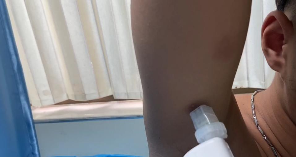 白癜风吃药控制住不复色行吗,白癜风不吃药的后果