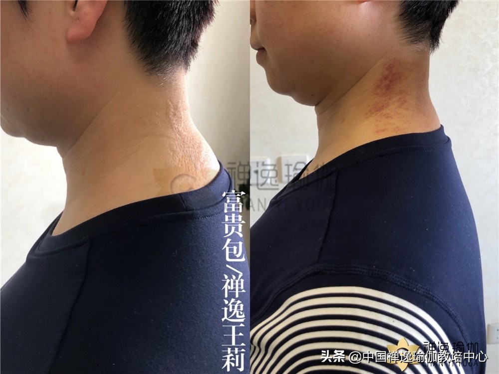 禅逸瑜伽培训学院曲江,瑜伽矫正驼背私教课