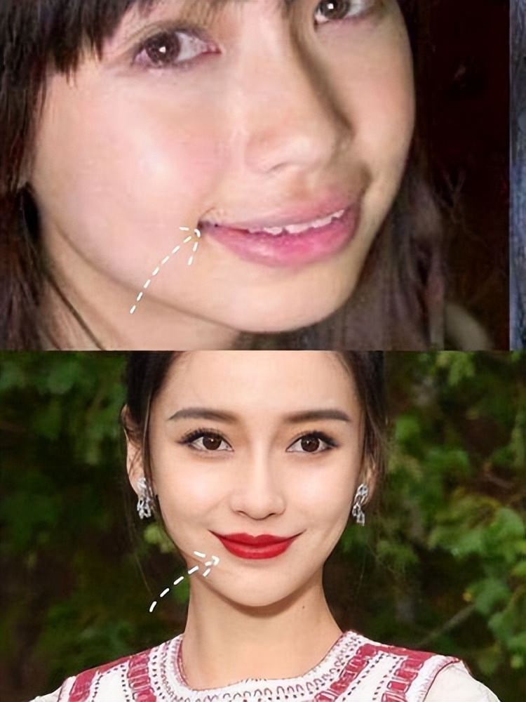 比法令纹更靠上的纹,嘴凸有法令纹改善对比