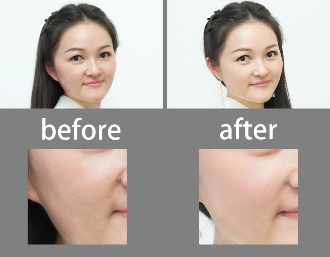 美肌试颜室‖直播见证，4周院线护肤的逆袭之路