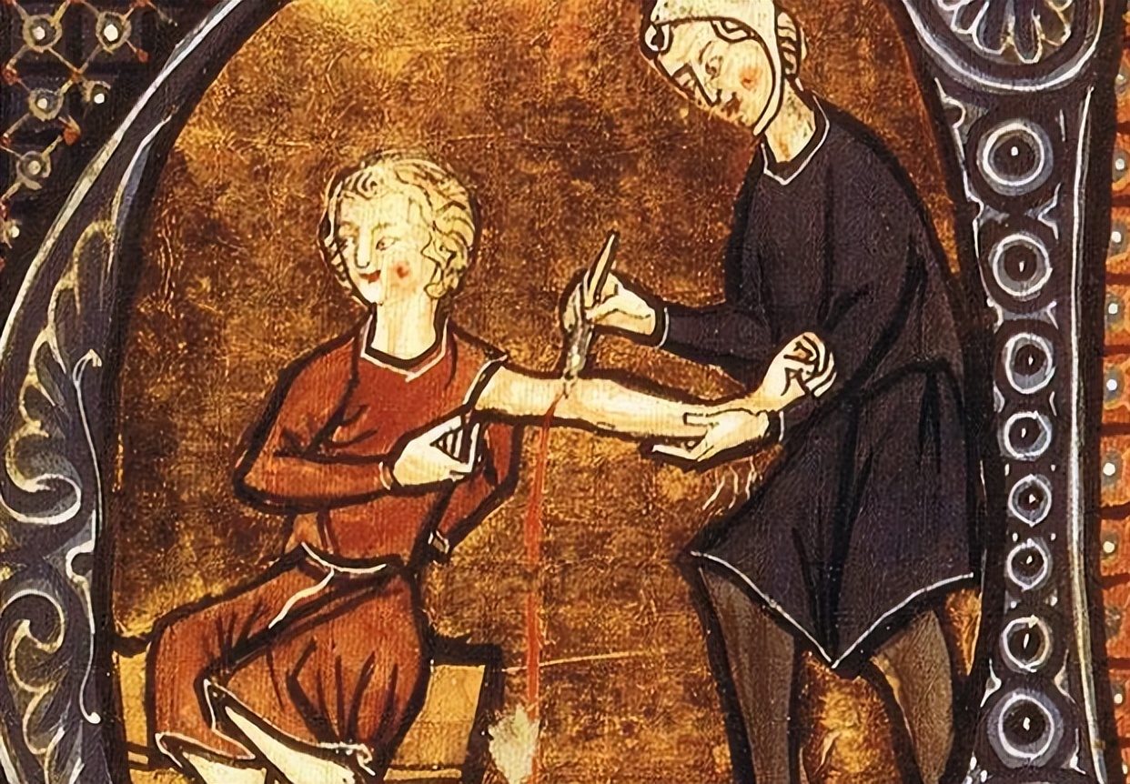 中世纪医疗方法,中世纪治病的方法