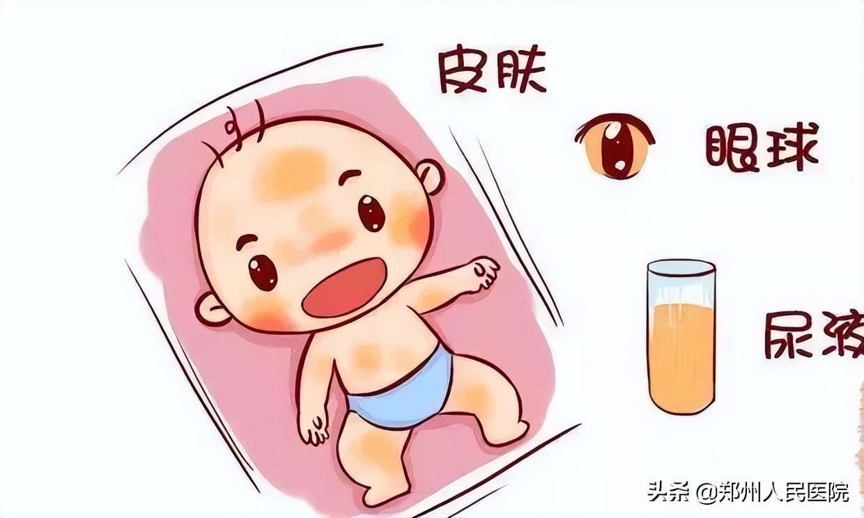 青记、马牙、假月经？别慌！新生儿这些情况都正常