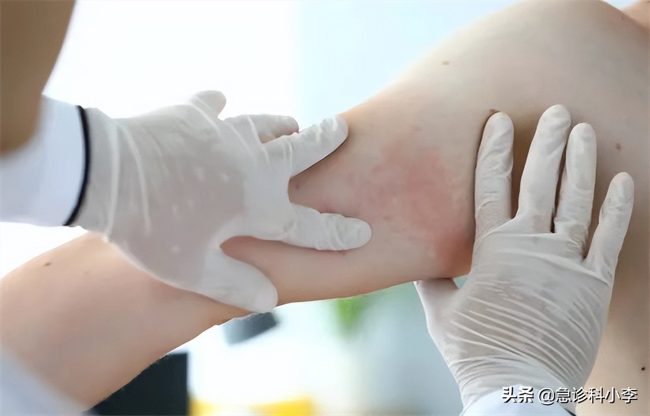 三种中药已被国家药典禁用,三种药已经禁用