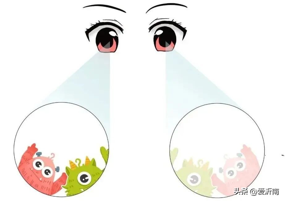 孩子两只眼睛度数相差100度,左右眼度数相差100