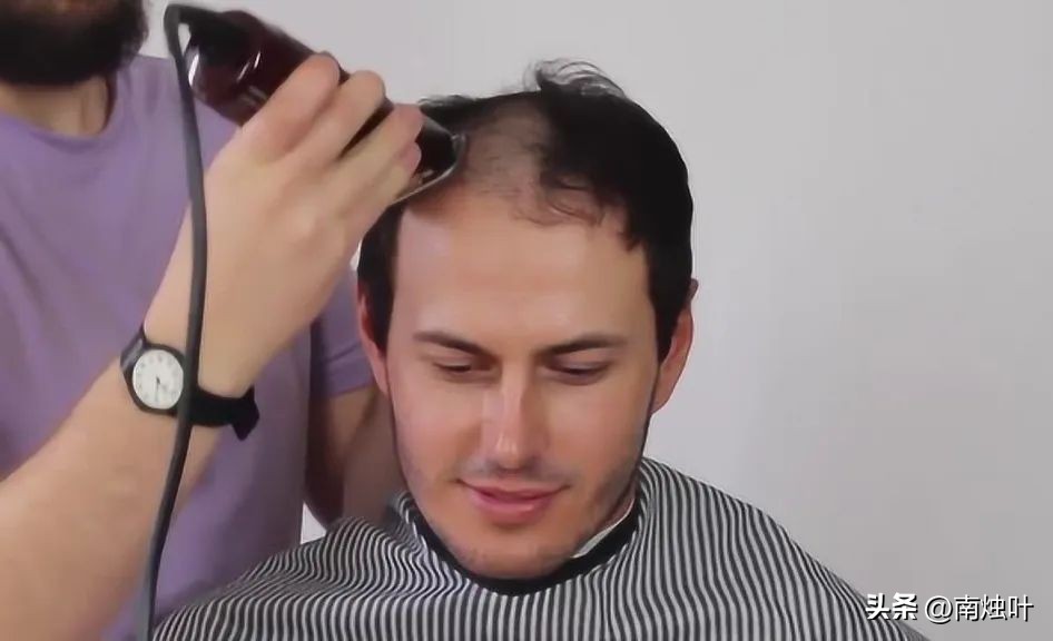 剃过头怎么让头发快速生长,头发真的会越剃越多吗