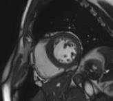 广元首台！智慧感知生命开启“设备配合病人”新时代