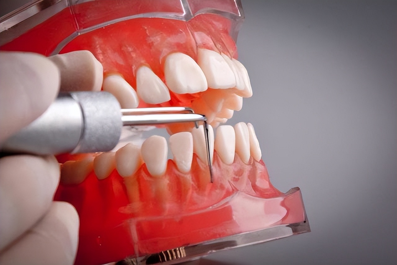 有一种痛叫口腔溃疡对症或能缓解,有一种痛叫做口腔溃疡如何缓解