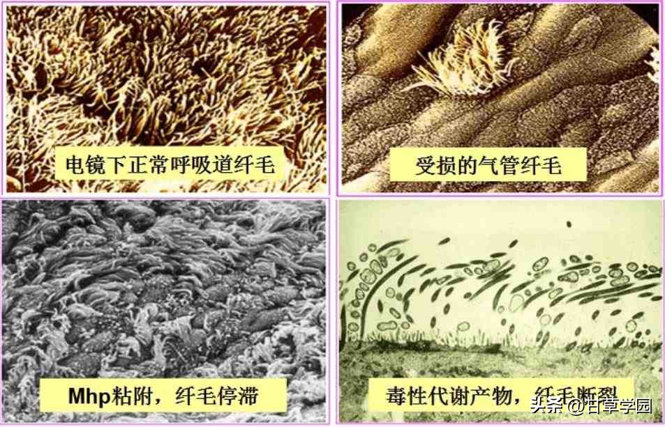 甘草片治疗支原体肺炎,甘草学园