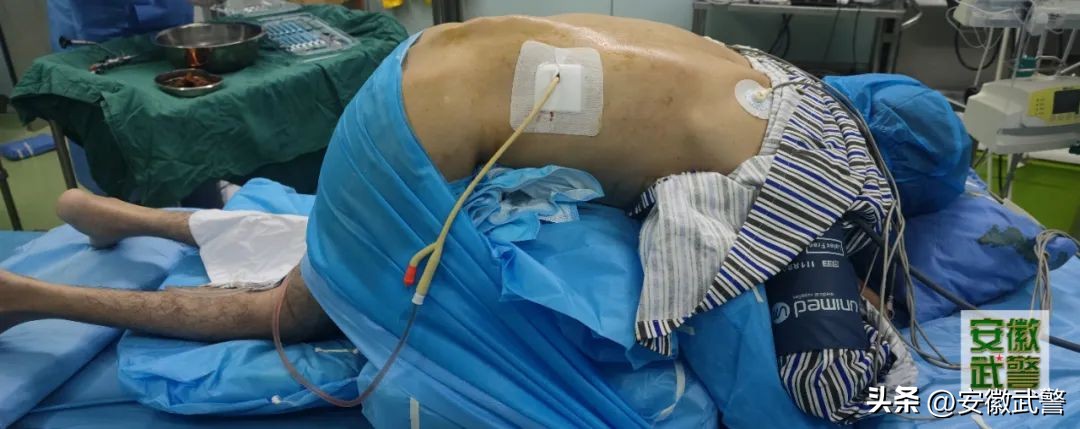 勇闯PCNL禁区——“*刀折**人”PCNL，勇敢者的较量！