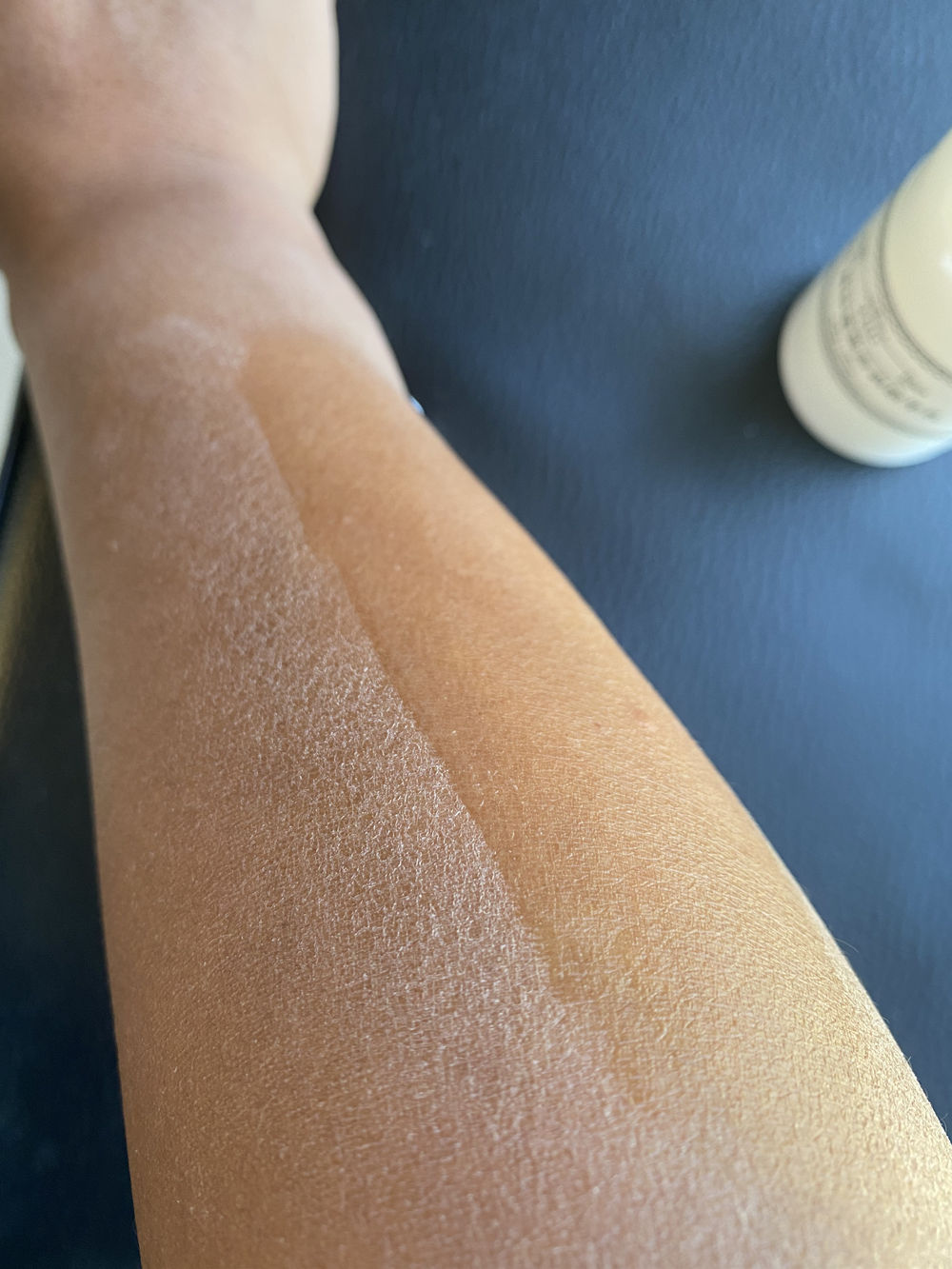 冬季皮肤干燥起皮有纹,皮肤干燥起蛇皮纹