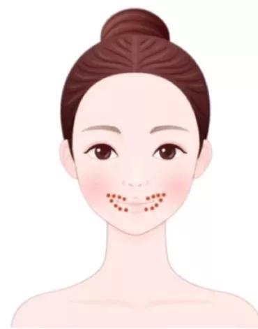 脸上有痘生活小妙招,你有什么方法改善脸上的痘痘