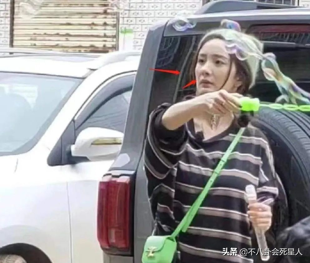 杨雪的脸怎么了,杨雪毁容了吗