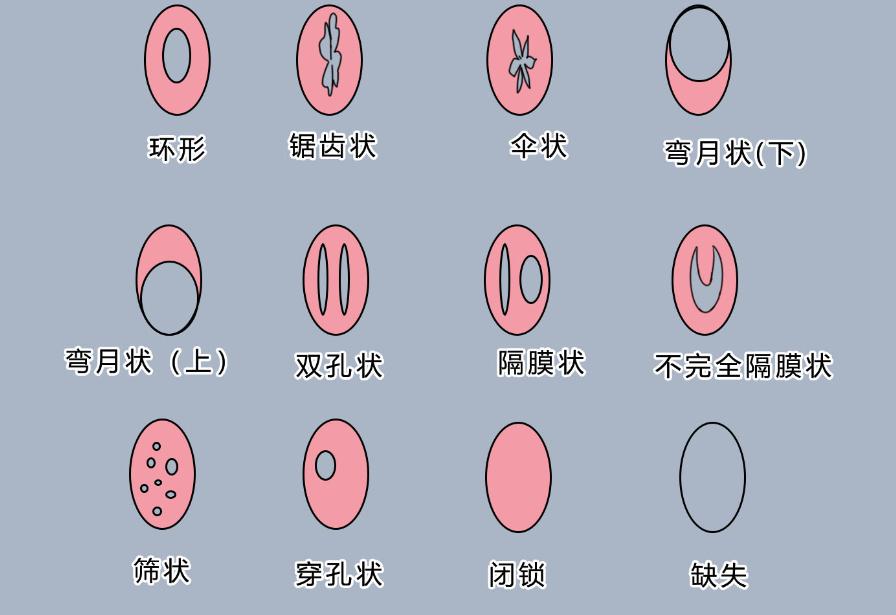 揭秘处女座内心秘密,处女座的大揭秘