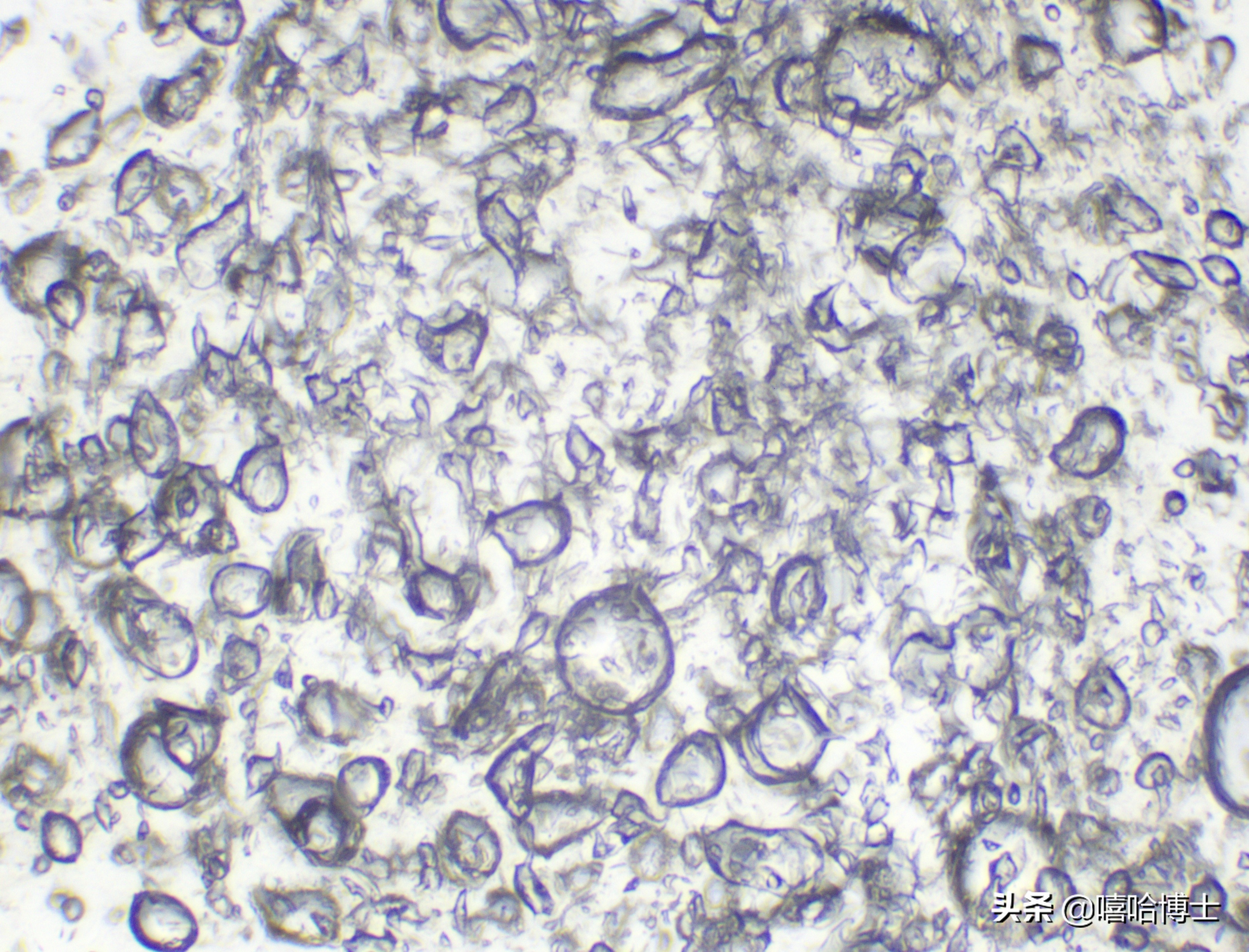 超级显微镜下的山竹,显微镜下的山竹果