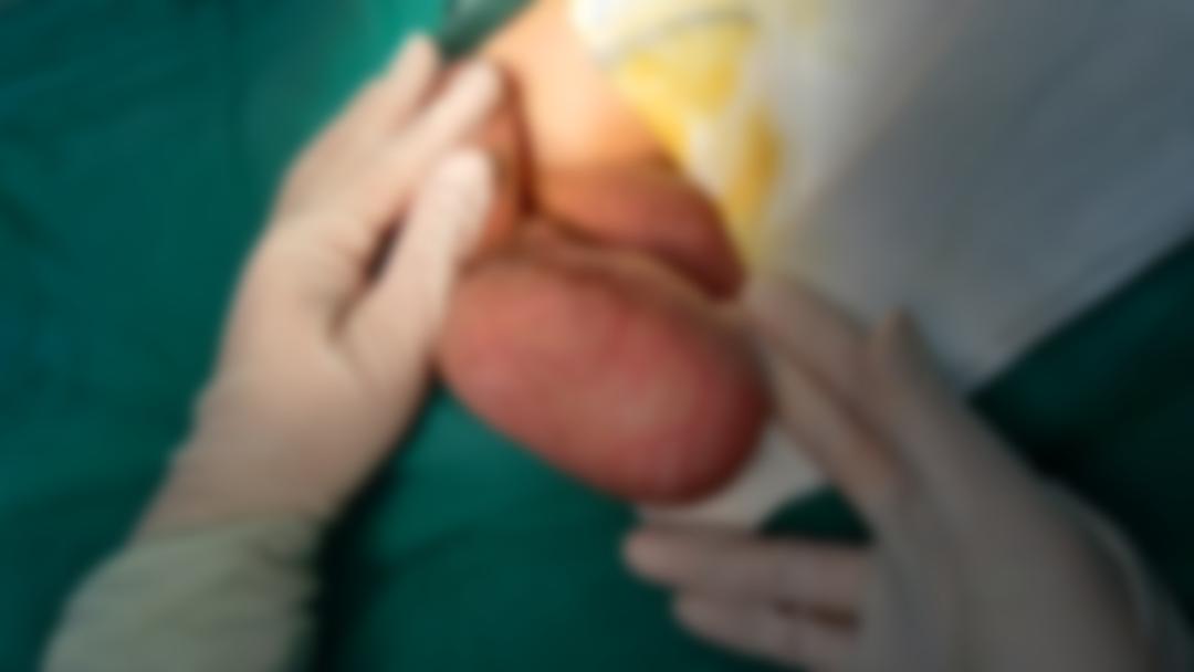 难言之隐泌尿外科,泌尿外科难言之隐