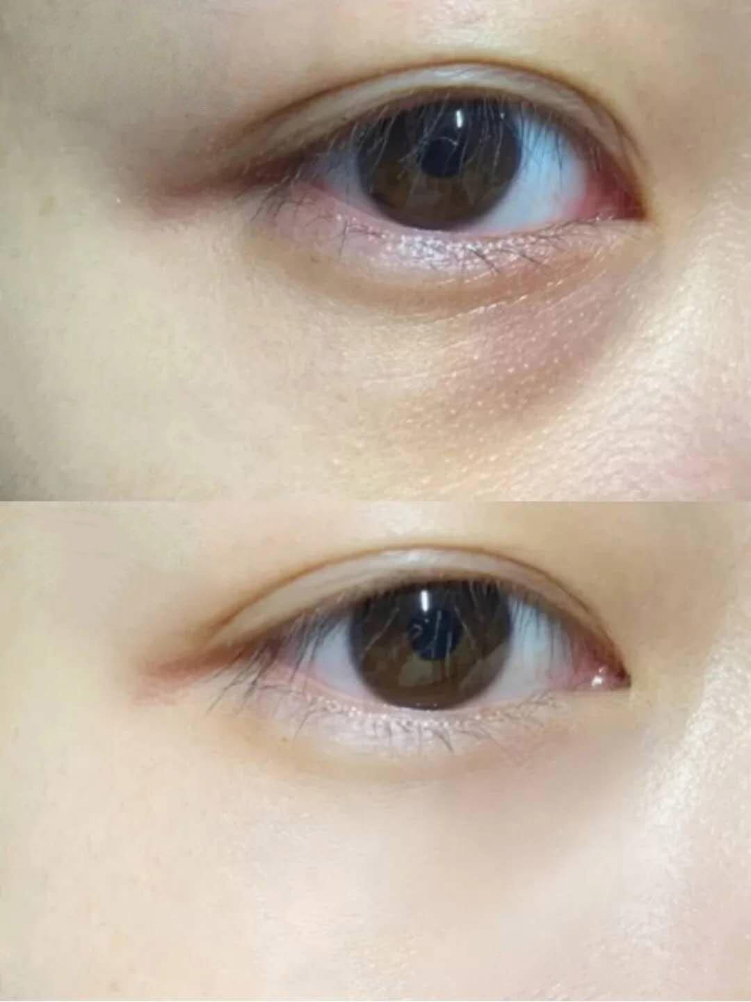 30+的女人用什么眼霜,抹眼霜都拯救不了眼纹