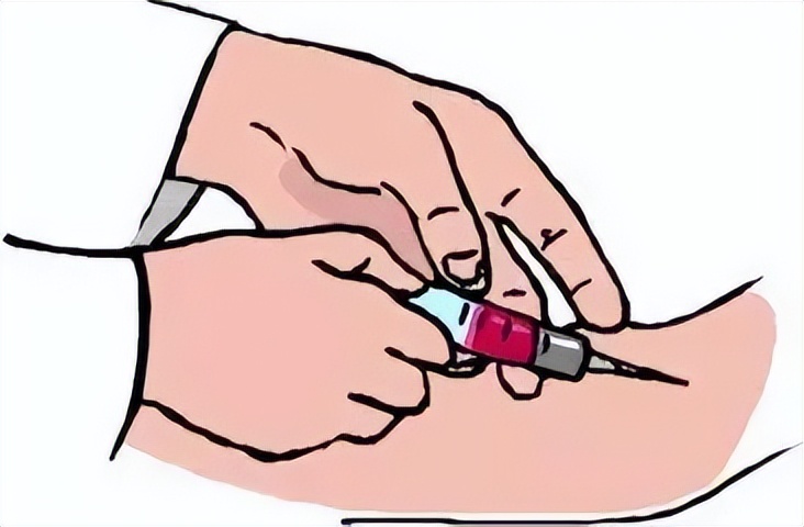 一代试管如何选择试管方案,试管各种方案的开始时间