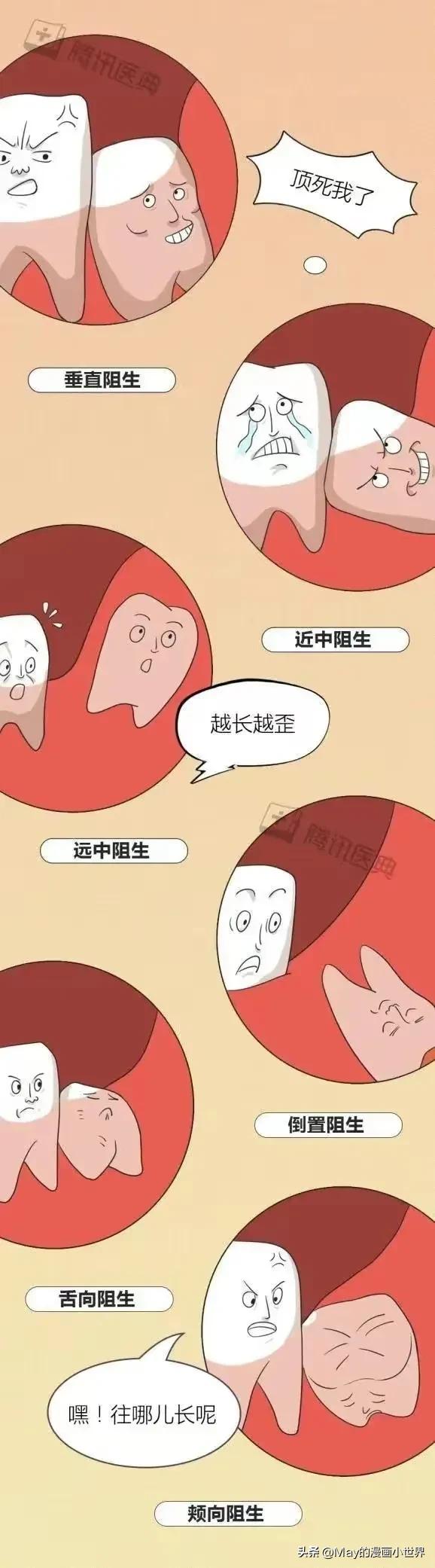 下智齿拔了上智齿正常不拔后果,不拔智齿怀孕有影响吗