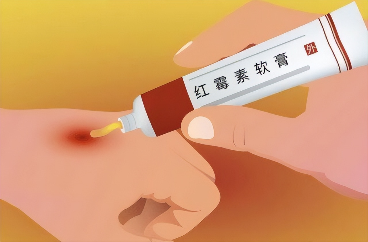 药店销售的十种药,药店4种药便宜又好用不外传