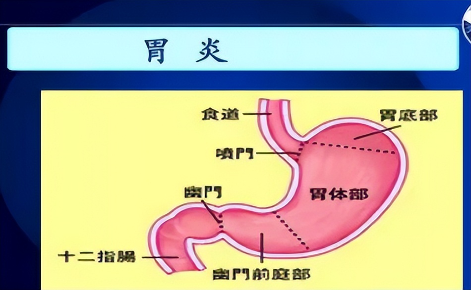 胃疼吃好多药无效怎么办,胃疼吃过胃药之后多久见效