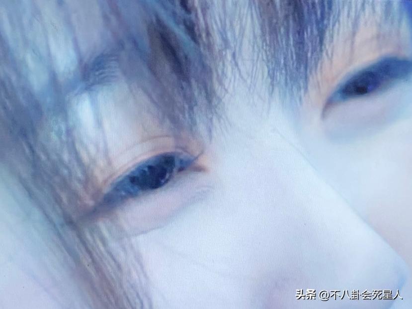 假双眼皮的明星,明星的假脸