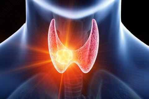 桥本甲状腺炎中医解释,中医对桥本氏甲状腺炎的认识