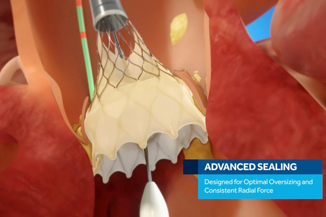 医疗器械带量采购最新官方消息,预防类医疗器械