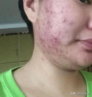 <html>
<head><title>502BadGateway</title></head>
<body>
<center><h1>502BadGateway</h1></center>
<hr><center>nginx</center>
</body>
</html>
<!--apaddingtodisableMSIEandChromefriendlyerrorpage-->
<!--apaddingtodisableMSIEandChromefriendlyerrorpage-->
<!--apaddingtodisableMSIEandChromefriendlyerrorpage-->
<!--apaddingtodisableMSIEandChromefriendlyerrorpage-->
<!--apaddingtodisableMSIEandChromefriendlyerrorpage-->
<!--apaddingtodisableMSIEandChromefriendlyerrorpage-->
